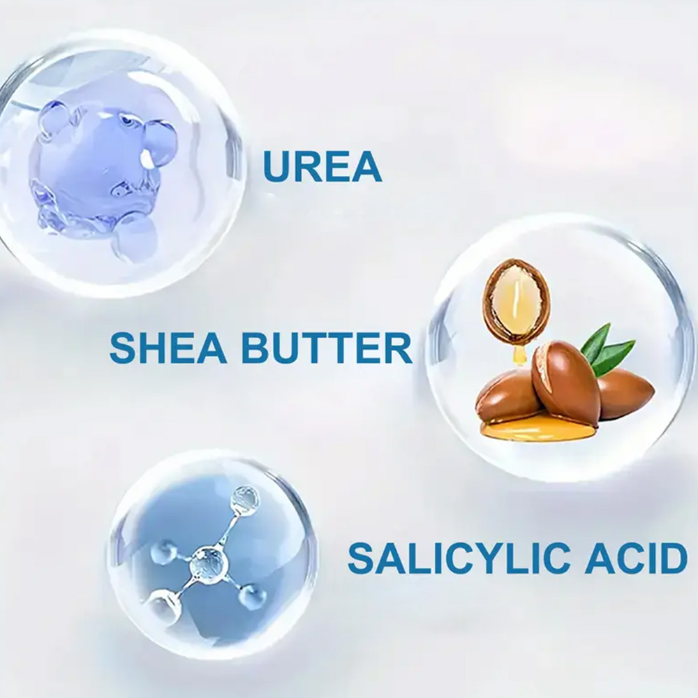 كريم يونجكوم 250 جرام من يوريا - مراجعة Urea Foot Cream وسعره