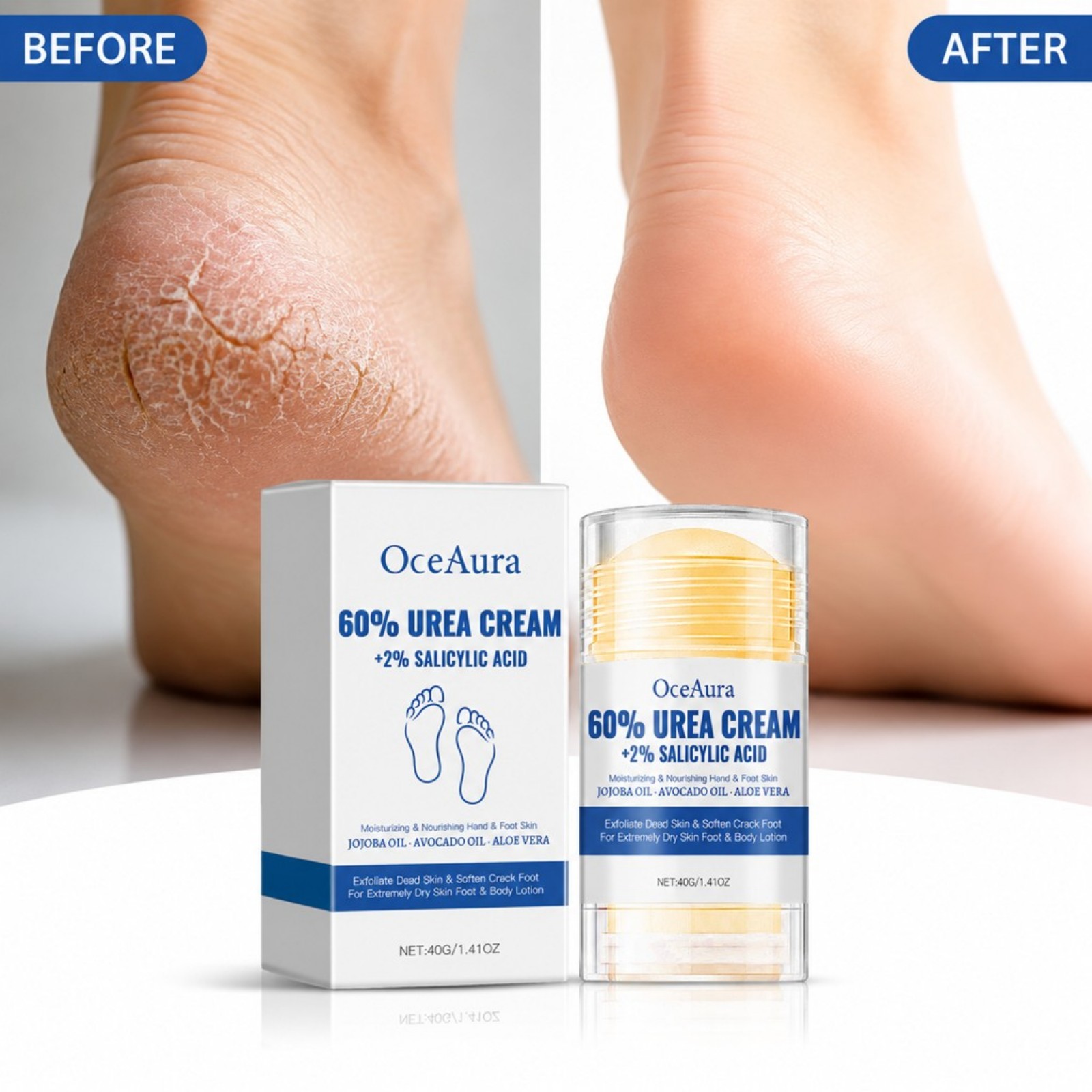 كريم العناية بالقدم بنسبة 60%  - مراجعة Urea Foot Cream وسعره