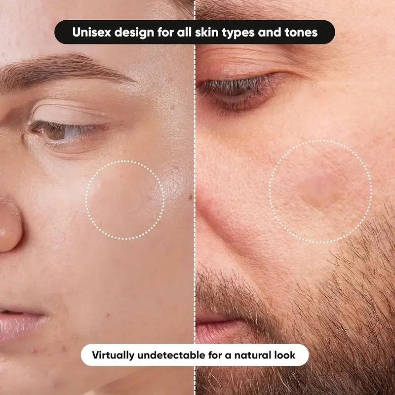 360 قطعة/صندوق رقع حب الشباب - - مراجعة Face Oil وسعره