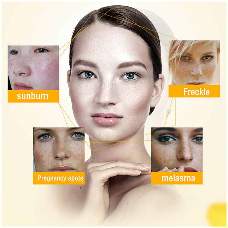 Dimollaure كريم تبييض النمش تر - مراجعة Retinol Cream وسعره