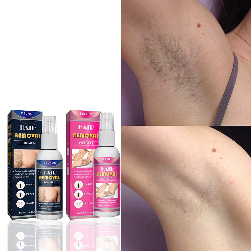 1/2 قطعة مزيل الشعر الدائم غير - مراجعة Body Lotion وسعره